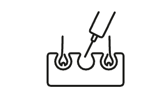 Icono de  Mesoterapia con Minoxidil